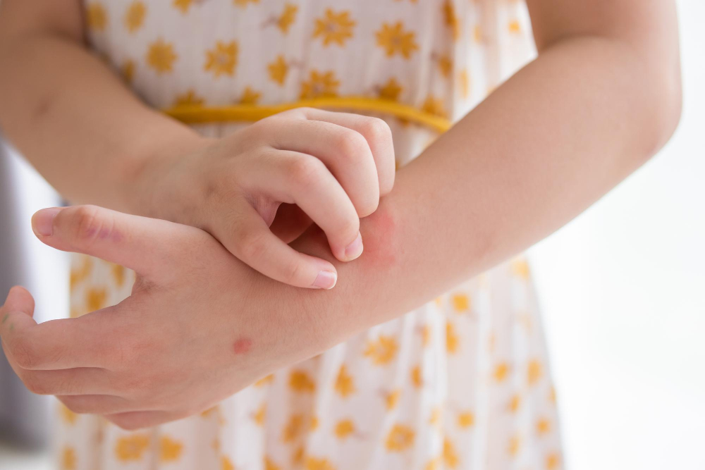 Dermatita seboreică: Cum să o ameliorezi eficace?